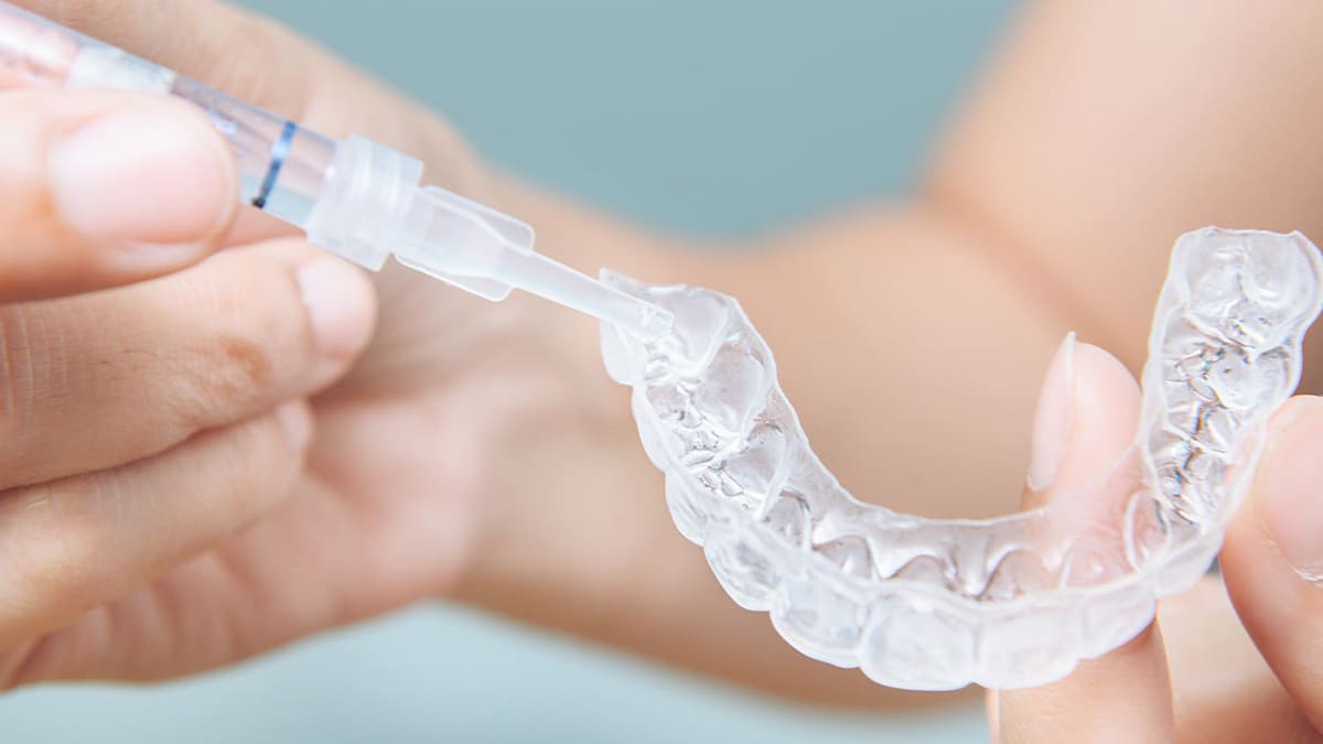 ホームホワイトニング剤とマウスピース