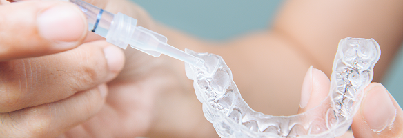 ホワイトニングのイメージ