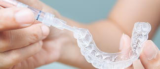 ホワイトニングのイメージ