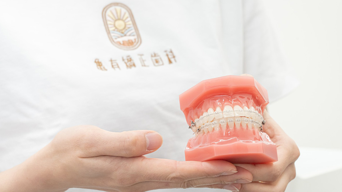 デジタルシミュレーションによる表側矯正の治療イメージ